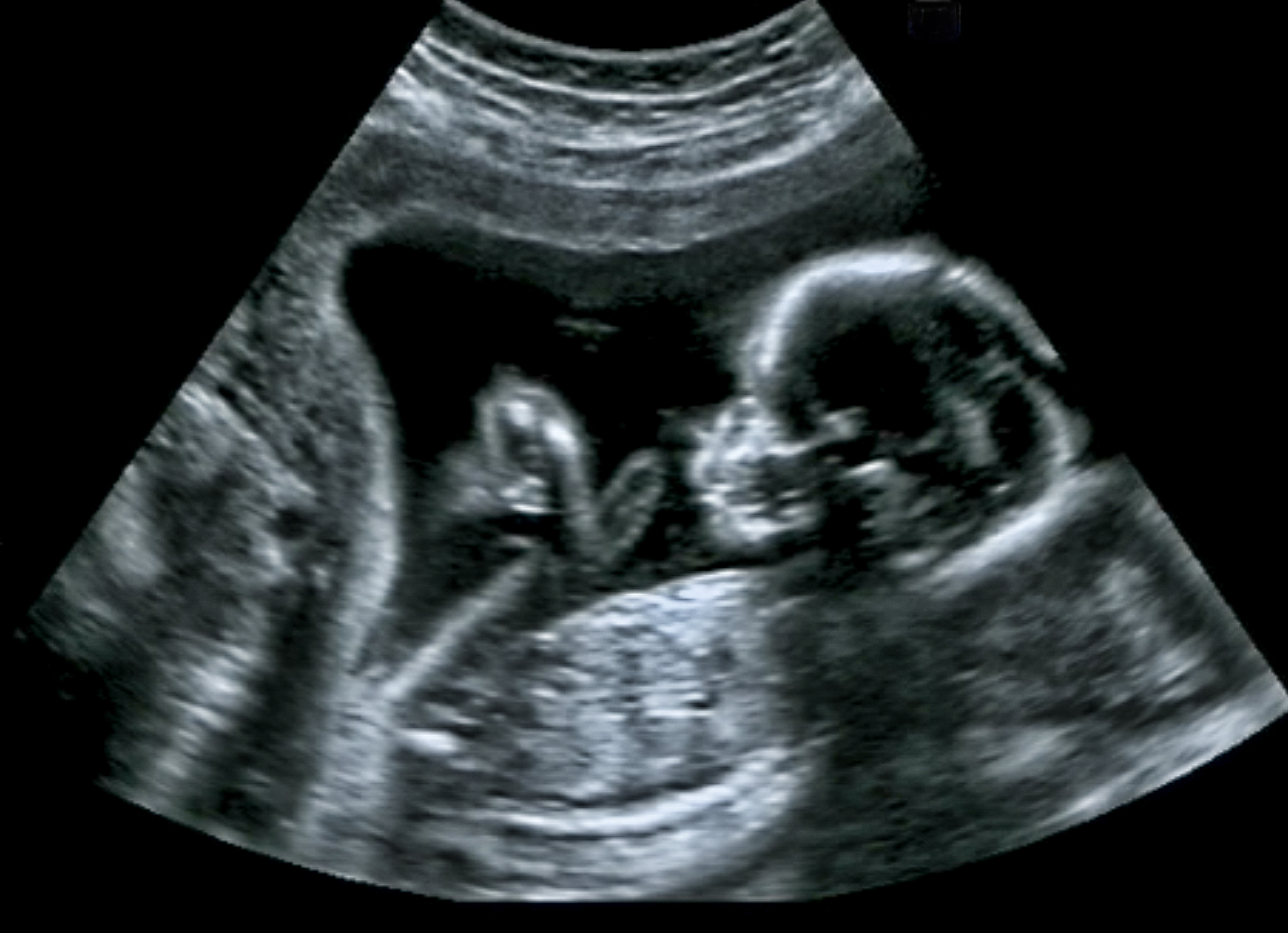 black and white baby ultra sound